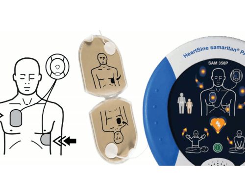 Desfibrilador externo semiautomático con sus parches y la ilustración de colocación en el pecho